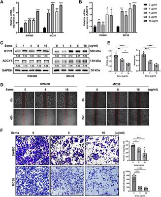 Comprehensively prognostic and immunological analyses of GLP-1 signaling-related genes in pan-cancer and validation in colorectal cancer